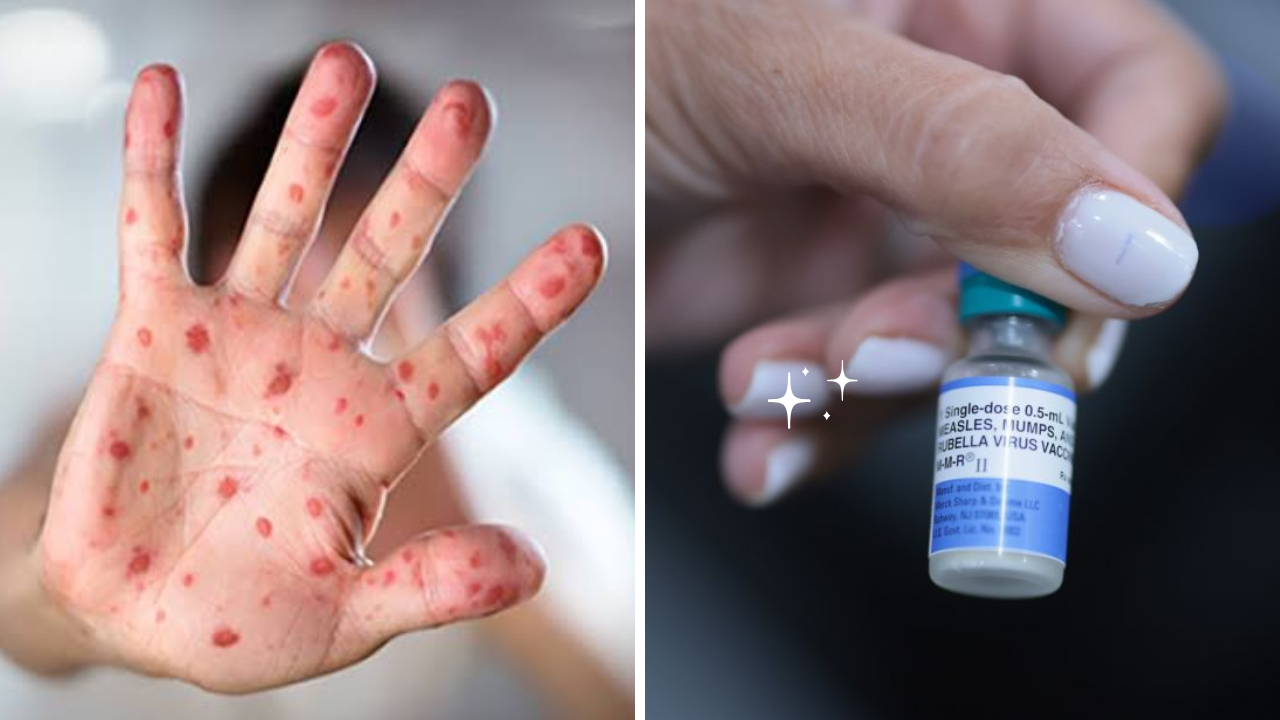 Pennsylvania Measles Outbreak Pushes More Amish Families Toward Vaccines
